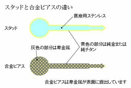 スタッド合金ピアスの違い